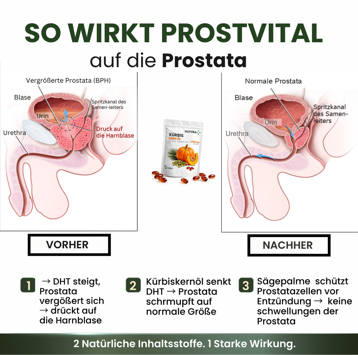 NaturaPlus™️ ProstVital