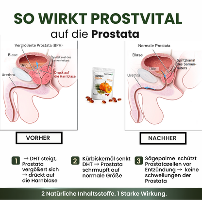 NaturaPlus™️ ProstVital